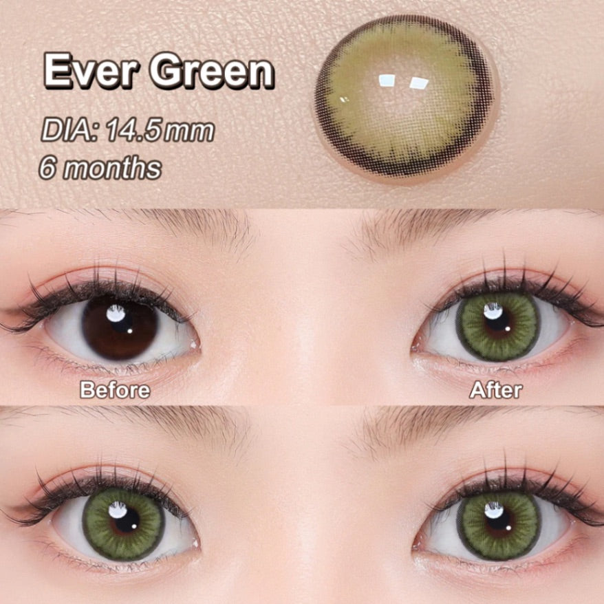 Ever Green  • 14.5 mm